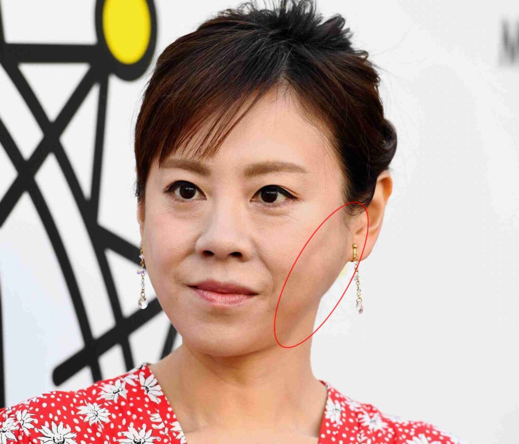 高橋真麻の顔が腫れてる理由は？病気・アレルギー説の真相と現在
