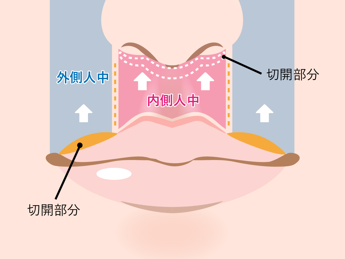 人中とはどこの部位？顔の印象が劇的に変わる黄金比と短縮術の真相