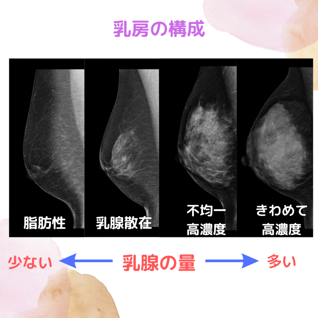 腸腰筋で見た目はどう激変する？体重減でも下腹凹まない真相と改善策