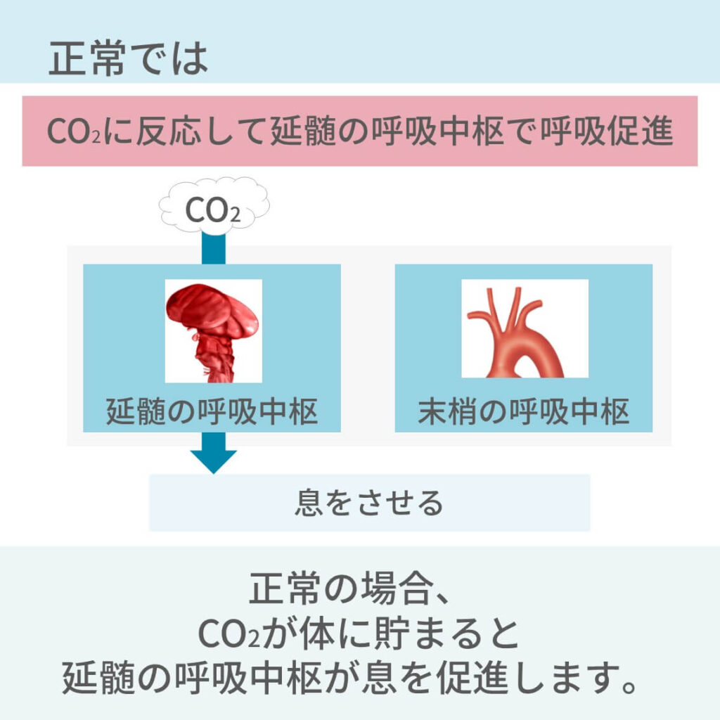 Co2ナルコーシスとは？酸素投与が招く呼吸停止の罠と初期症状