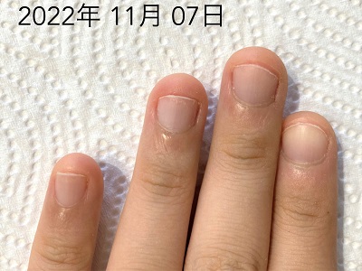 【熱愛】 爪 が 早く 伸びる 方法 最新ニュース速報 2026 #778
