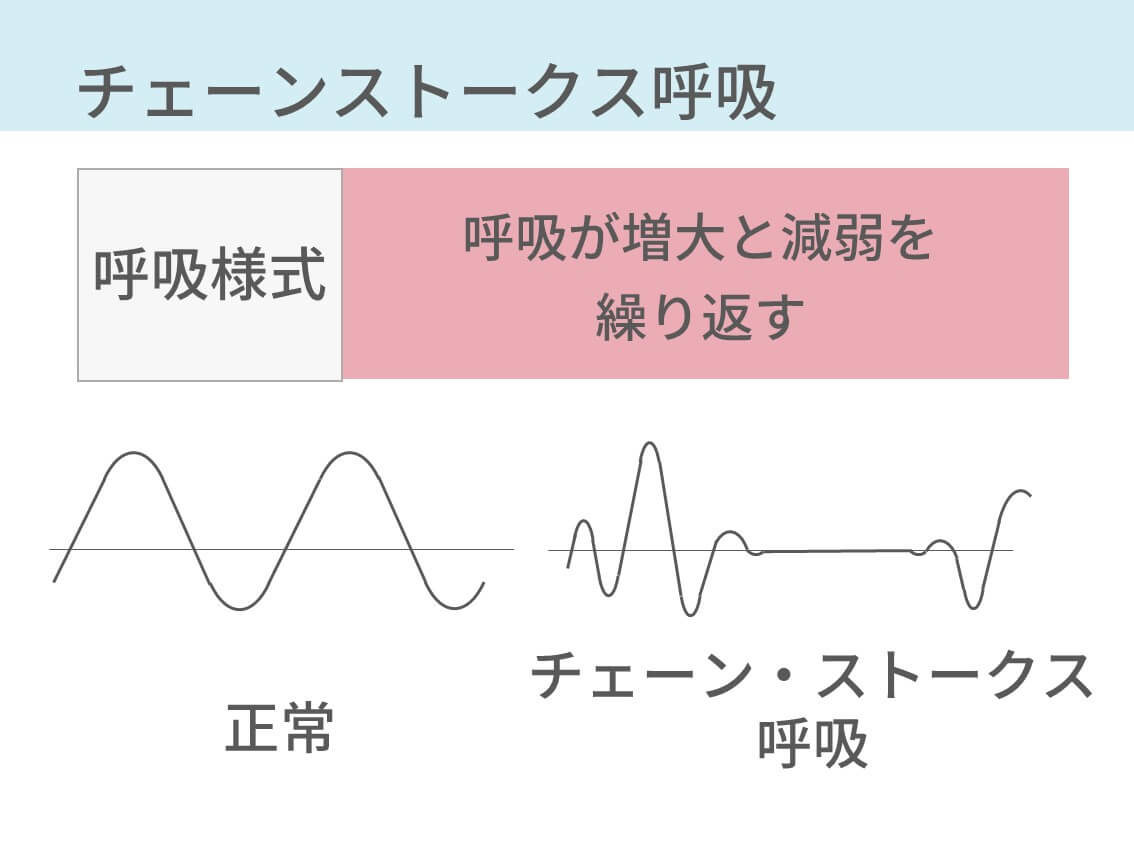 【2026年最新医療】夜間に静かに進む危険なサイン「チェーンストークス呼吸」を見逃すな！心不全の予兆から最新Ai検知技術まで徹底解説