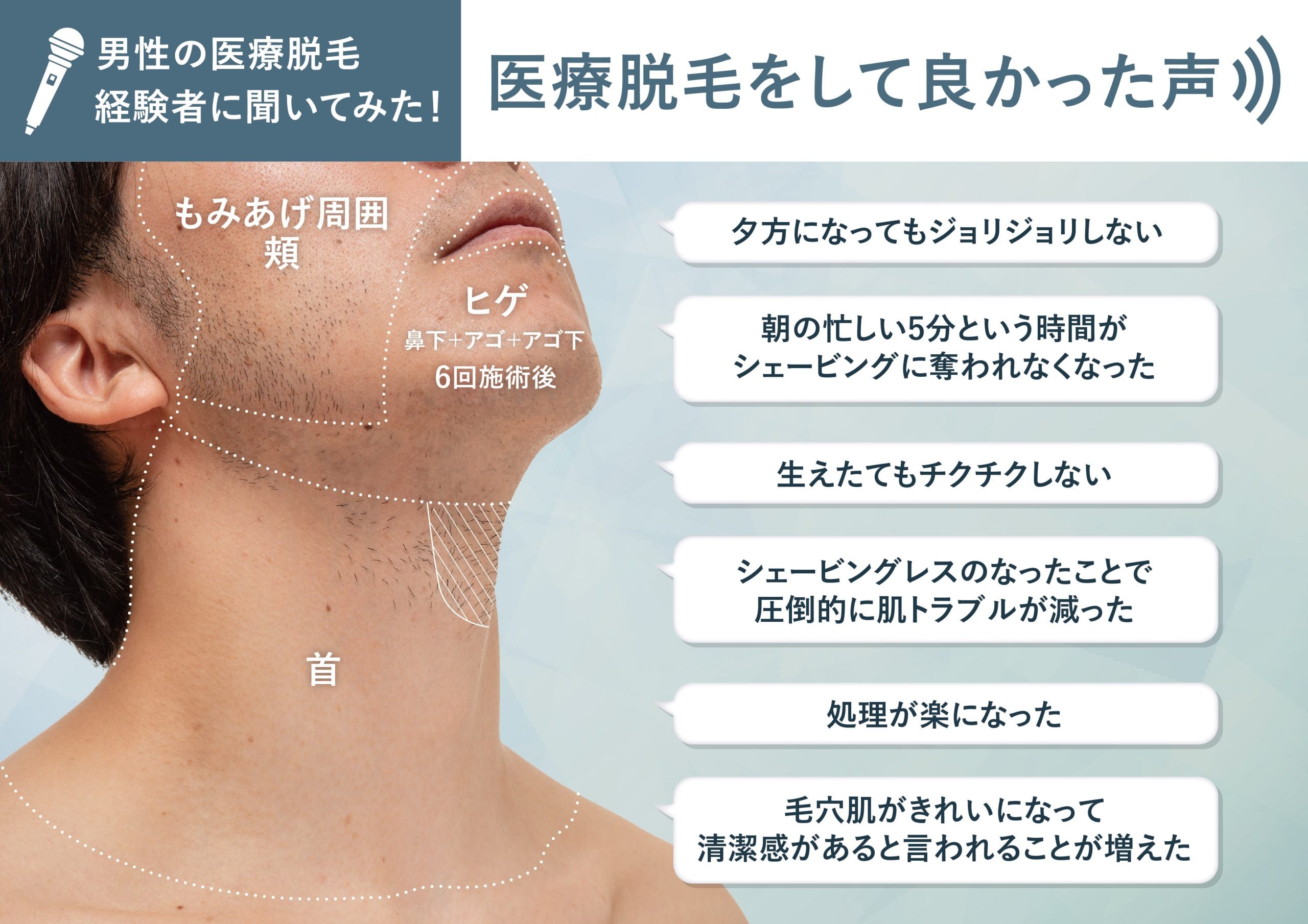 湘南美容外科メンズ脱毛の真実！効果と痛みの噂や後悔理由を徹底検証