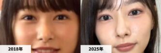 【インスタ画像】 桜井 の のか 整形 人気理由と評判まとめ #794