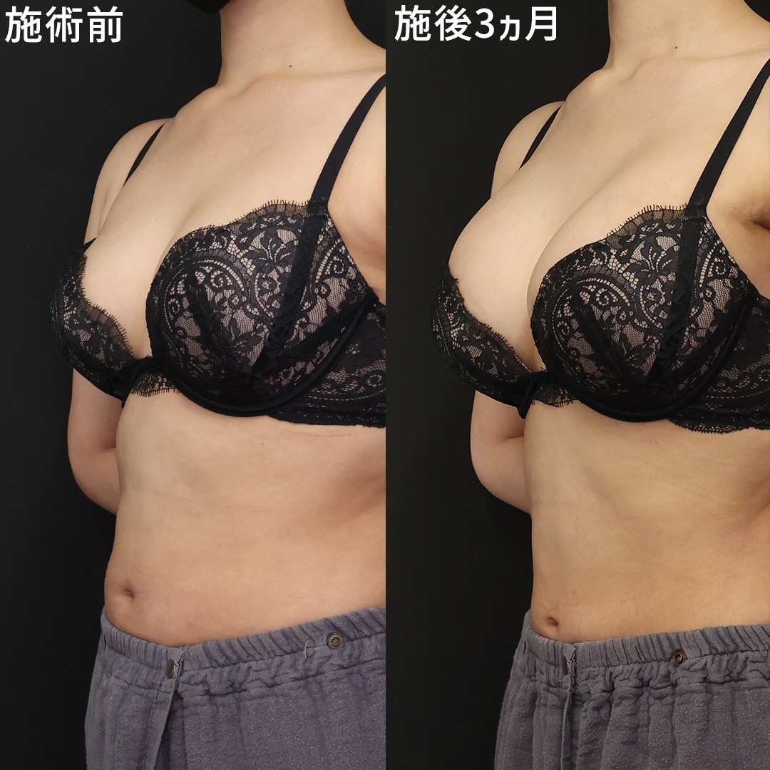 憧れのお椀型の胸へ！美乳の黄金比率と2026年最新の育乳習慣