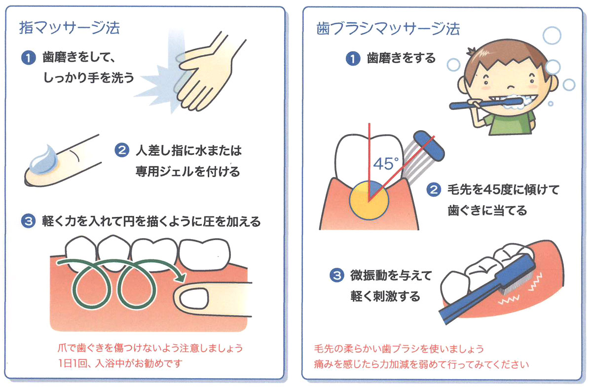 下がった歯茎はマッサージで戻る？噂の真相と2026年の再生治療法