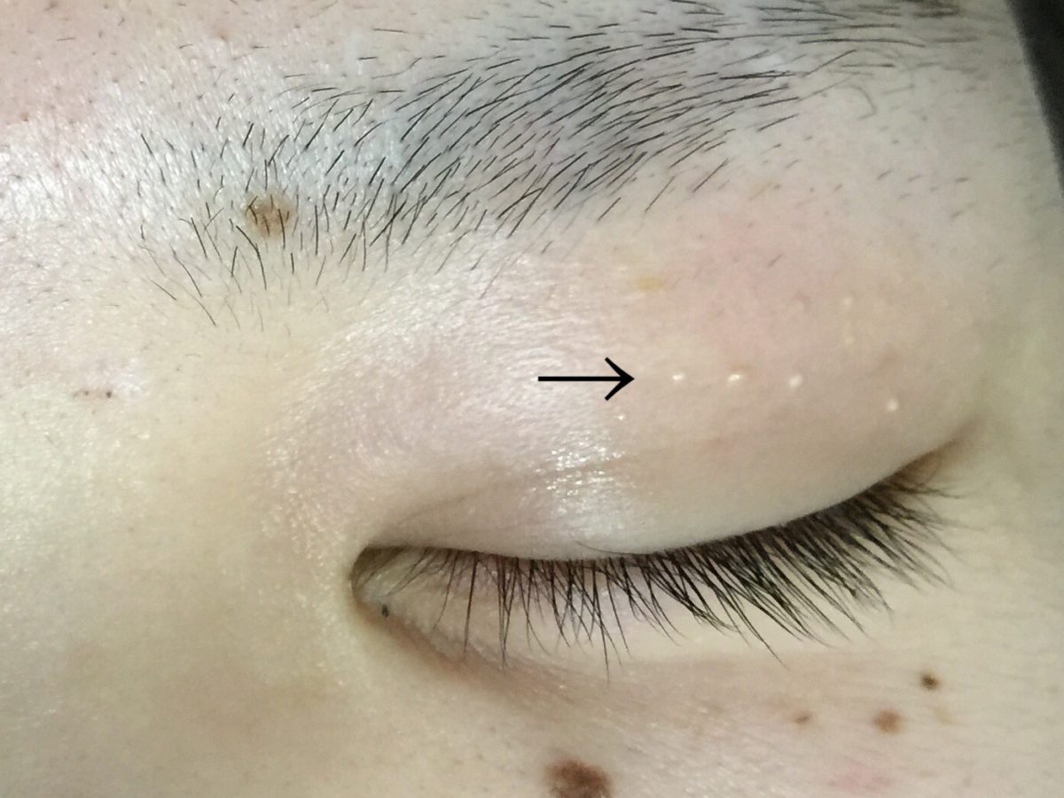 物上代位とは？なぜ差押えが必要なのか成立要件と最新判例を徹底解説