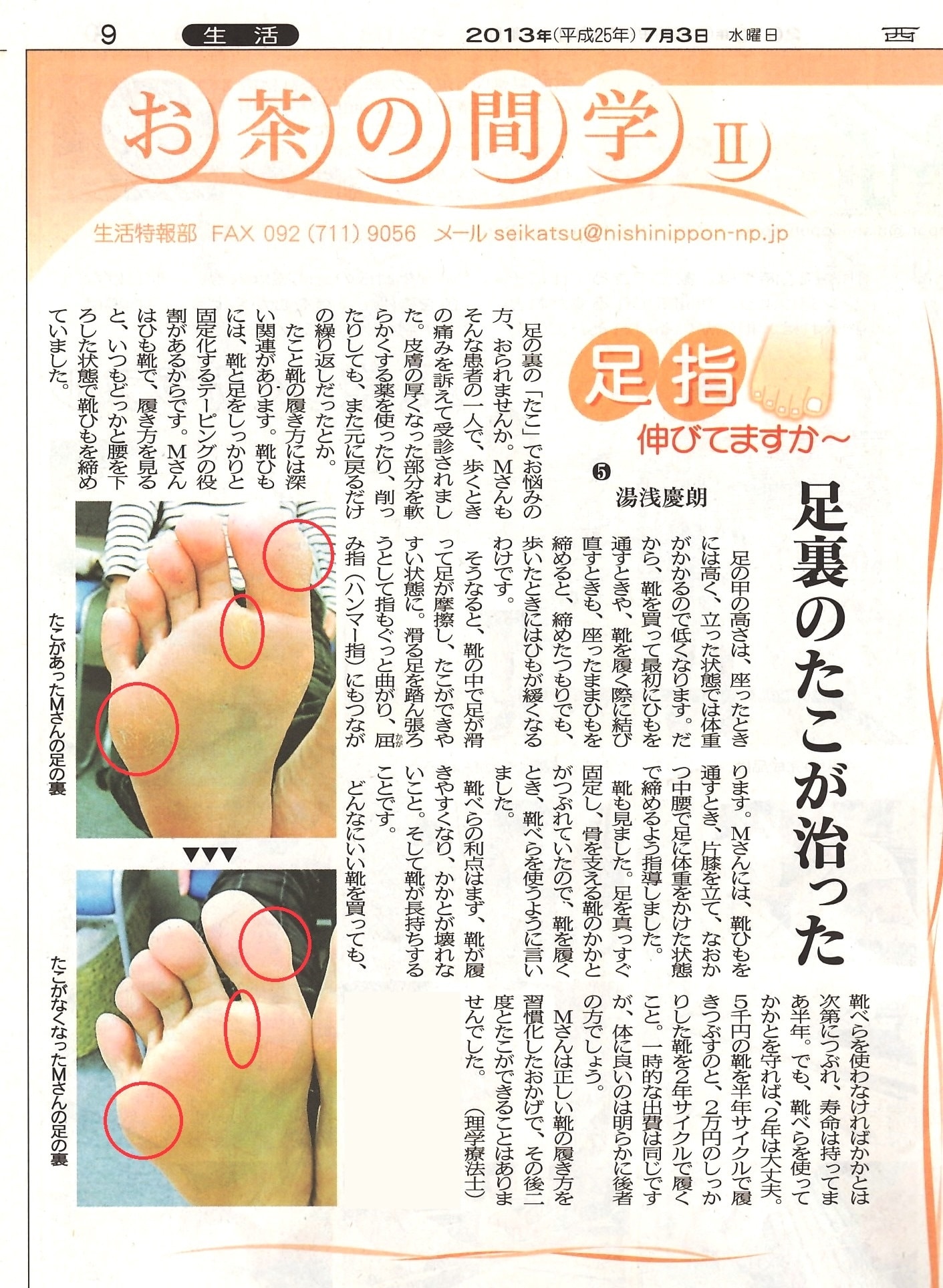 足のタコの治し方完全版！無理に削るリスクと皮膚科推奨の根本改善法