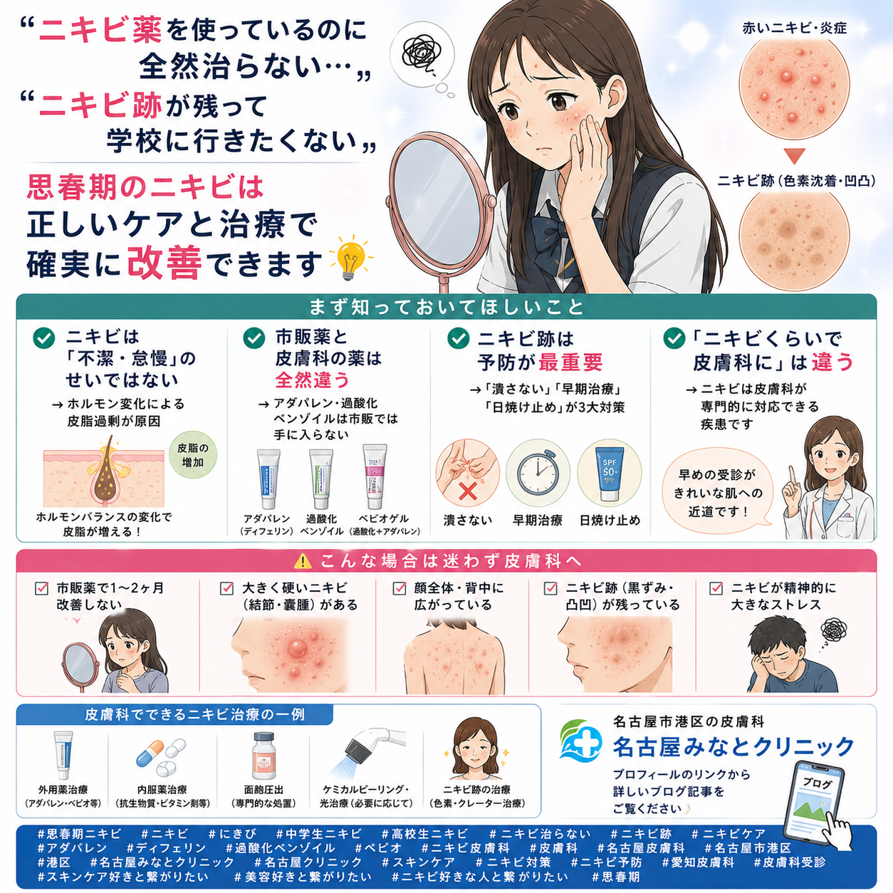 思春期ニキビを即効で治す方法！一晩で赤みを引かせる2026最新処方