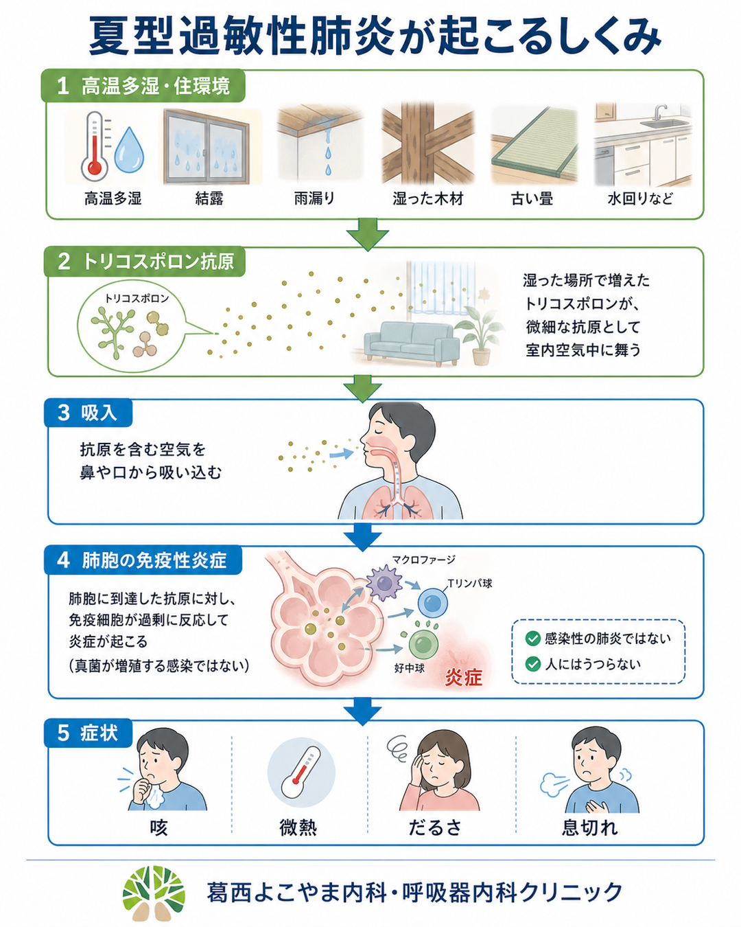 帰宅すると咳が止まらない？夏型過敏性肺炎の正体と治し方【2026】
