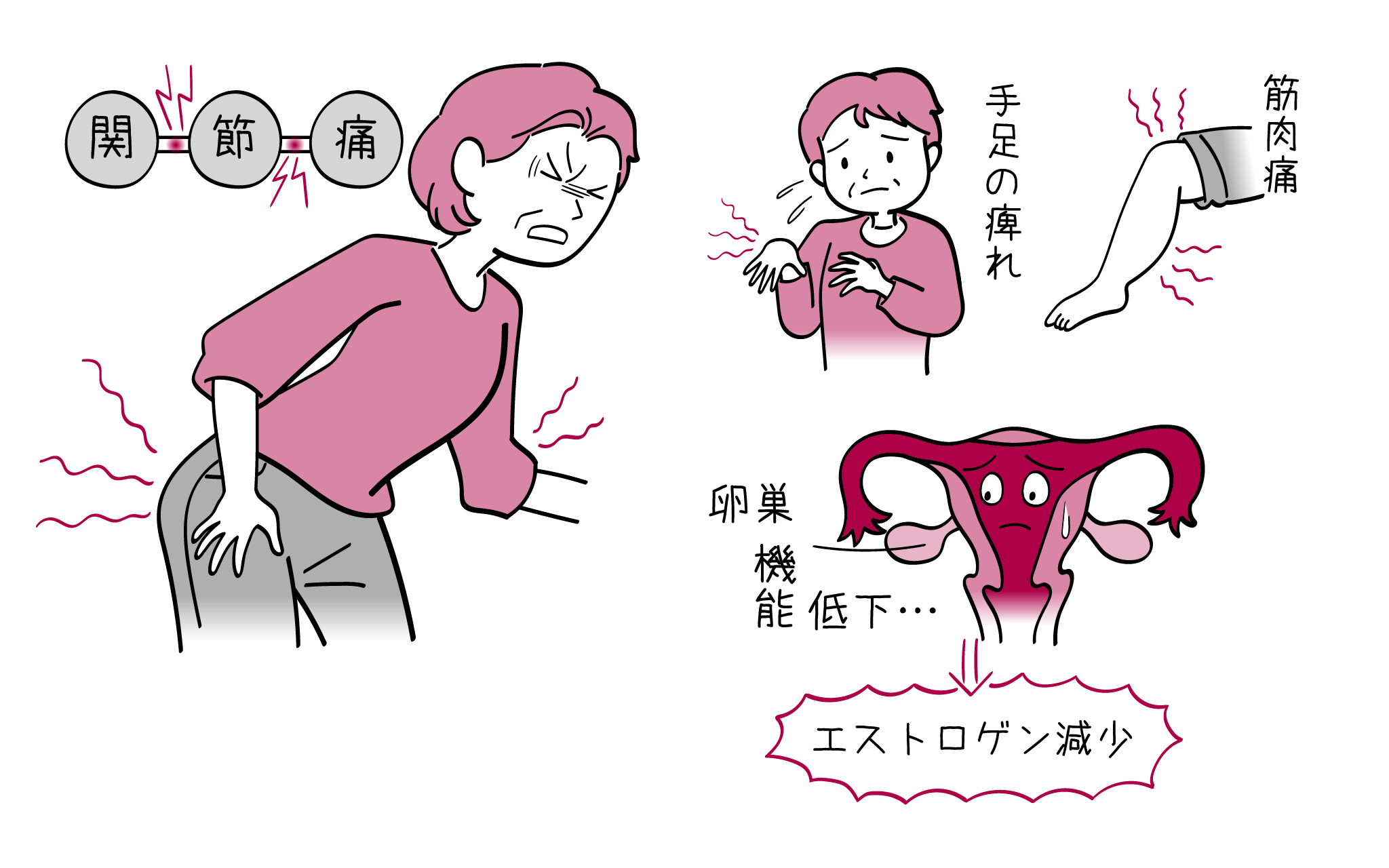 朝の手指のこわばりはなぜ？更年期関節痛の決定打と2026年最新対策