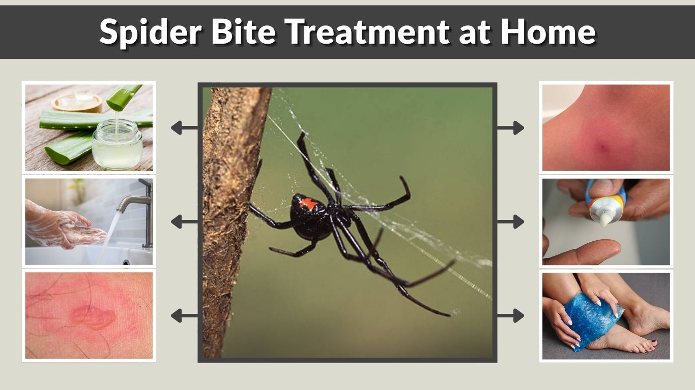 How to Heal a Spider Bite at Home