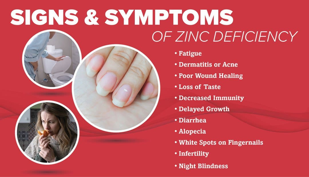 Symptoms of Zinc Deficiency in Females