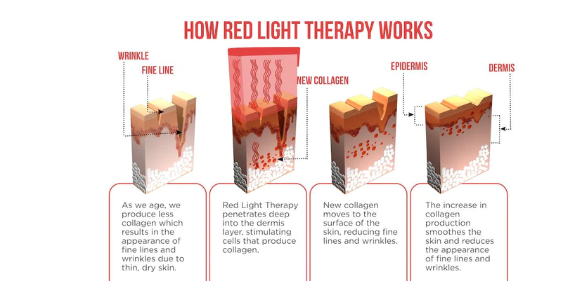 Does Red Light Therapy Help with Sagging Skin