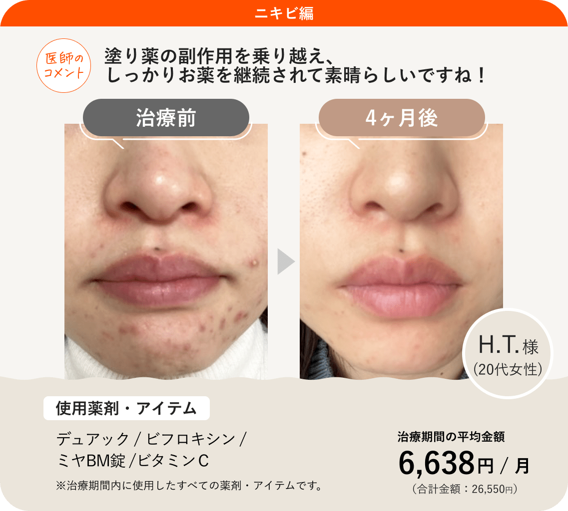 ミヤBmの効果と真実！ビオフェルミンとの違いや痩せる噂の真相に迫る