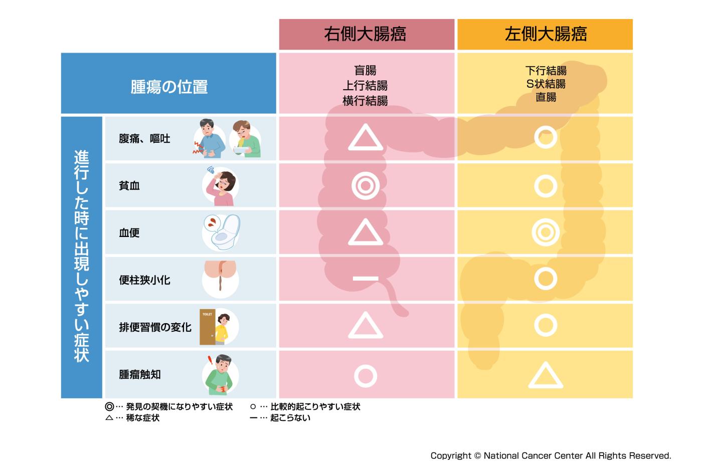 大腸がんの初期症状は自覚できる？便の異変や痔との見分け方