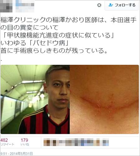 本田圭佑の病気説の真相！首の手術痕や目の異変と2026年現在の体調