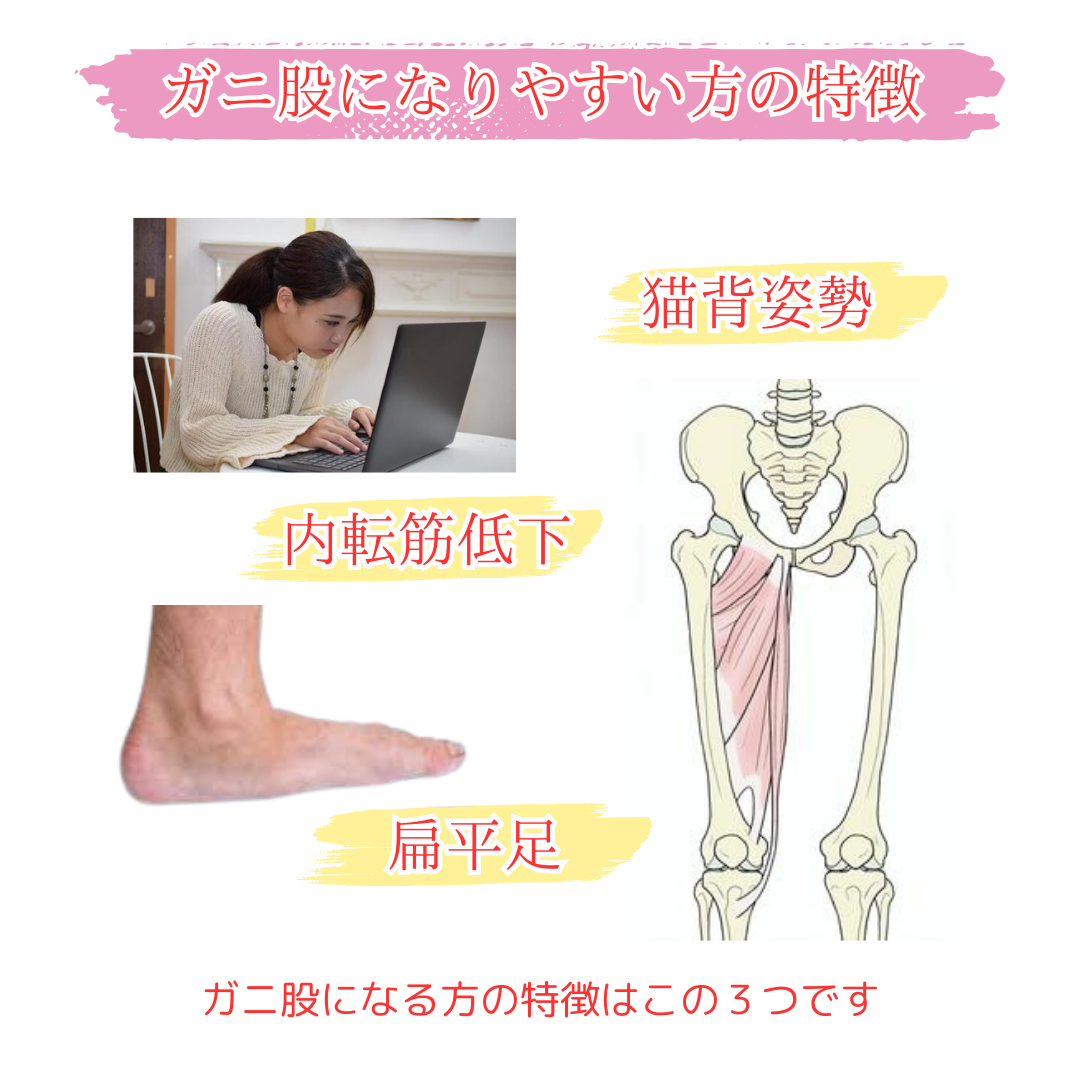 ガニ股とは？O脚との違いや原因・放置リスクと正しい治し方を徹底解説