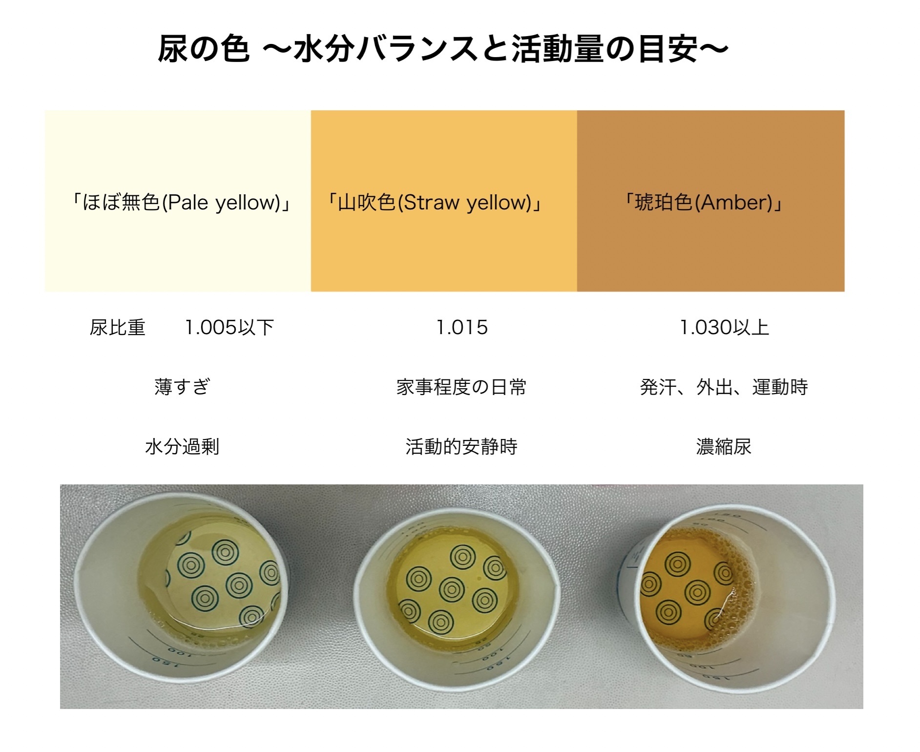 尿の色の写真と見本でセルフ判定！危険な変色サインと受診基準【最新】