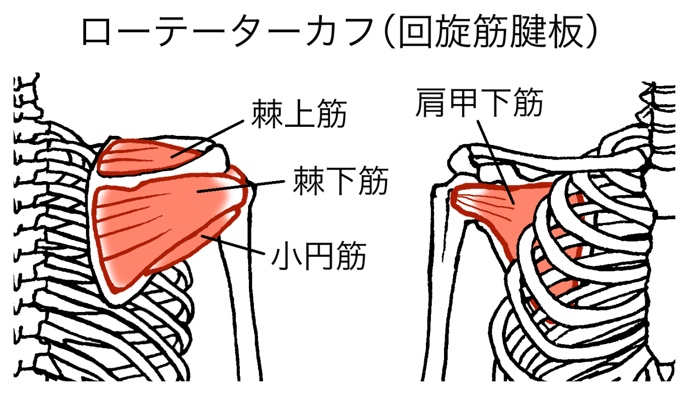 肩の激痛は五十肩か腱板断裂か？ローテーターカフの真相と最新治療