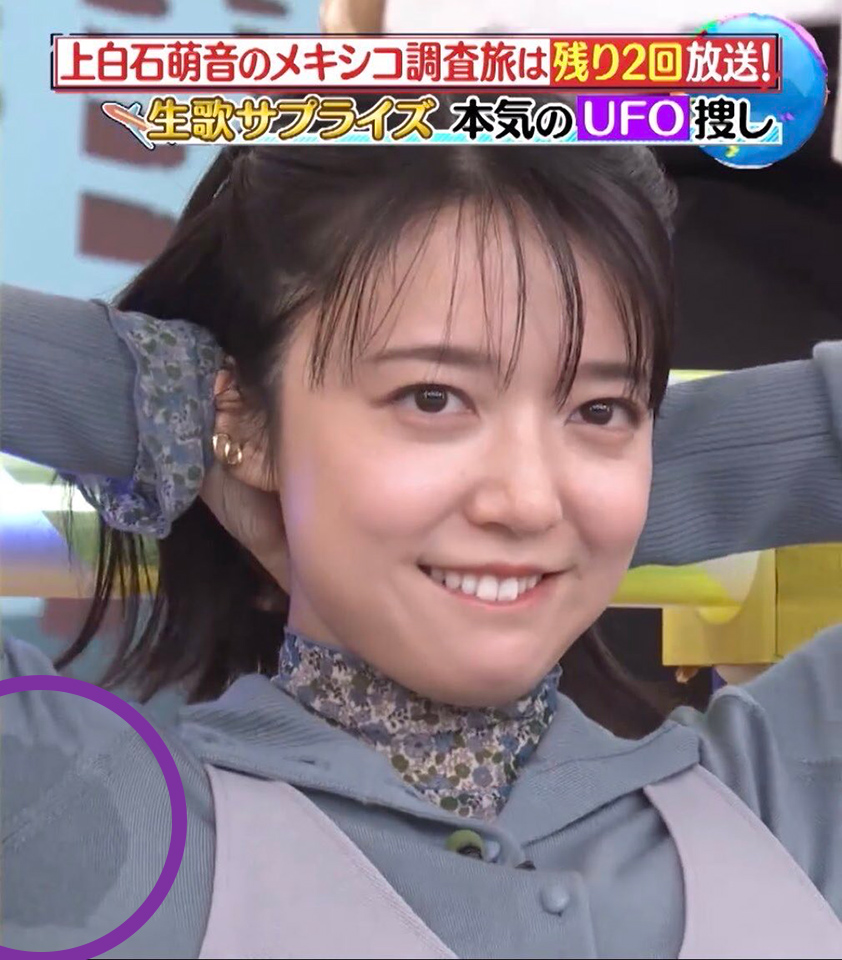 脇汗がひどい芸能人の真相！生放送ハプニングと多汗症対策の真実を追う