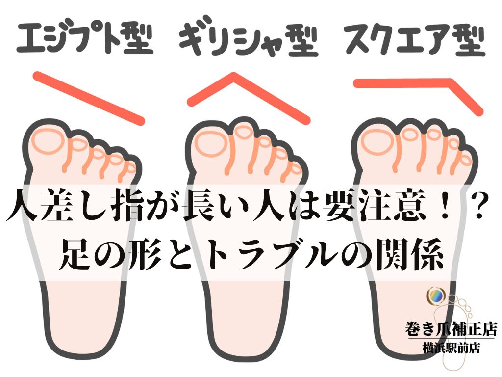 足の人差し指が長い人の隠れた才能とは？ギリシャ型の真実と靴選び