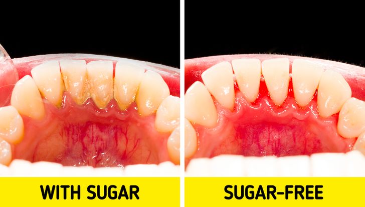 Is Extra Gum Bad for Your Teeth