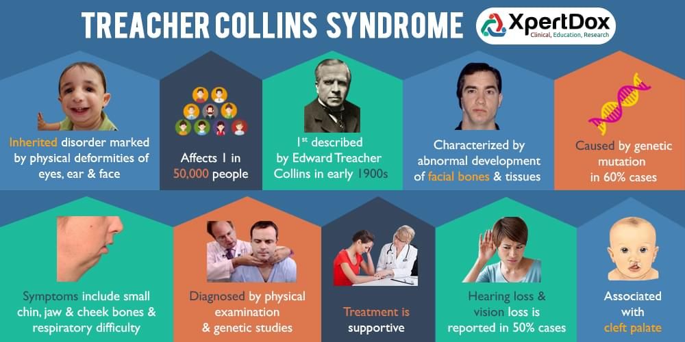 10 Interesting Facts About Treacher Collins Syndrome