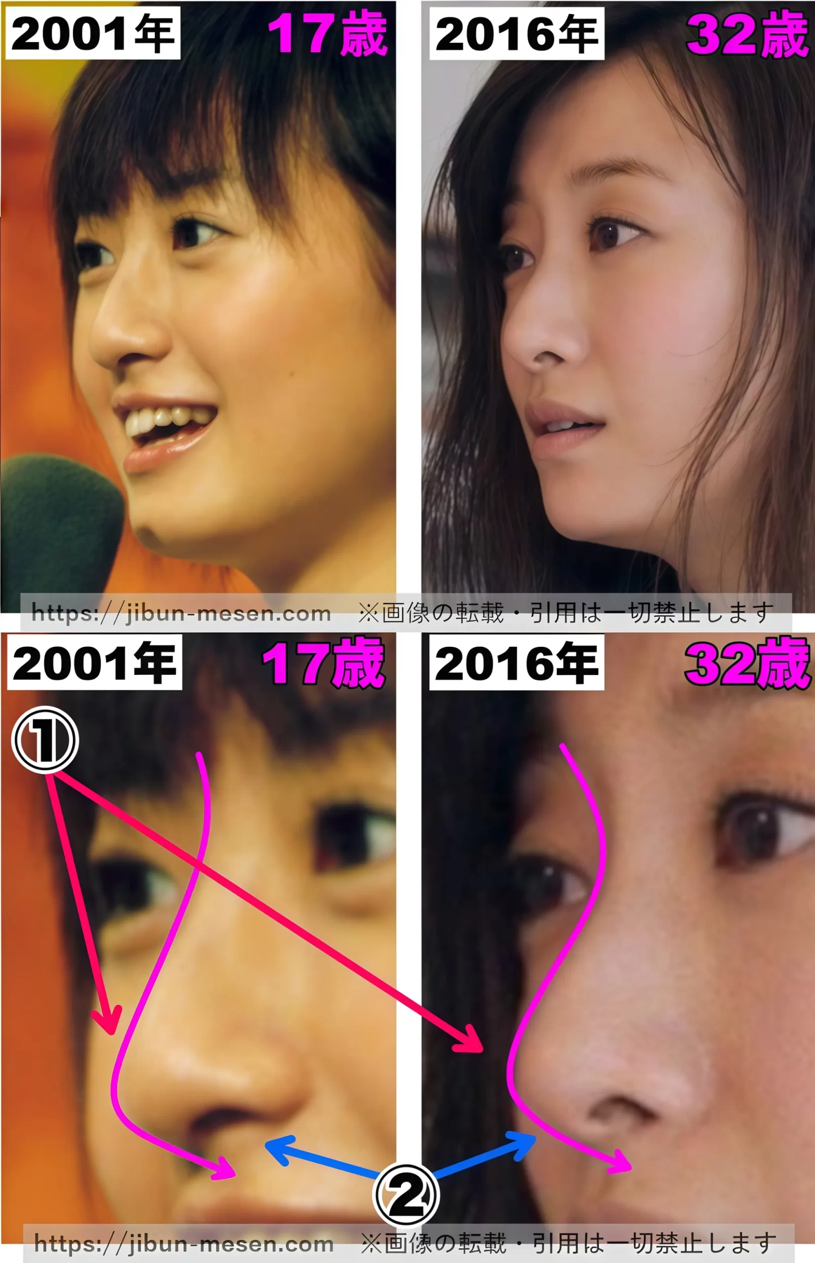 松本まりかの整形疑惑を検証！昔と現在の顔立ち変化や垢抜けの真相
