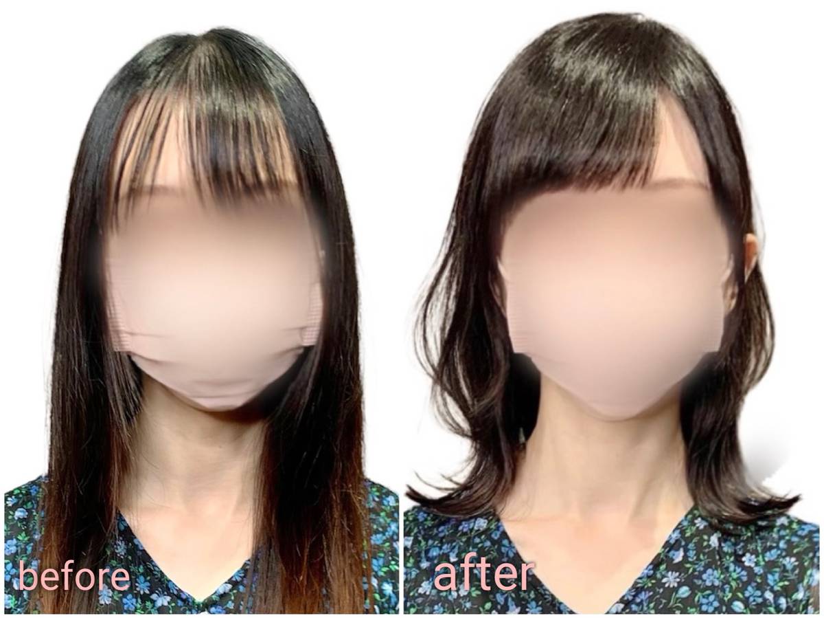 前髪の地肌が透ける女性の悩み急増！薄毛のサインと即効隠しセット術