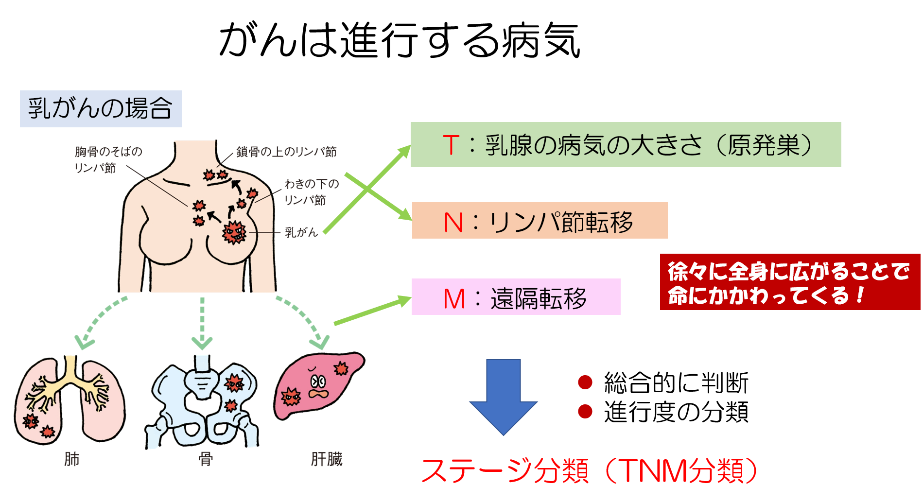 乳癌の種類とサブタイプ別の特徴｜治療方針と悪性度の違いを徹底解説