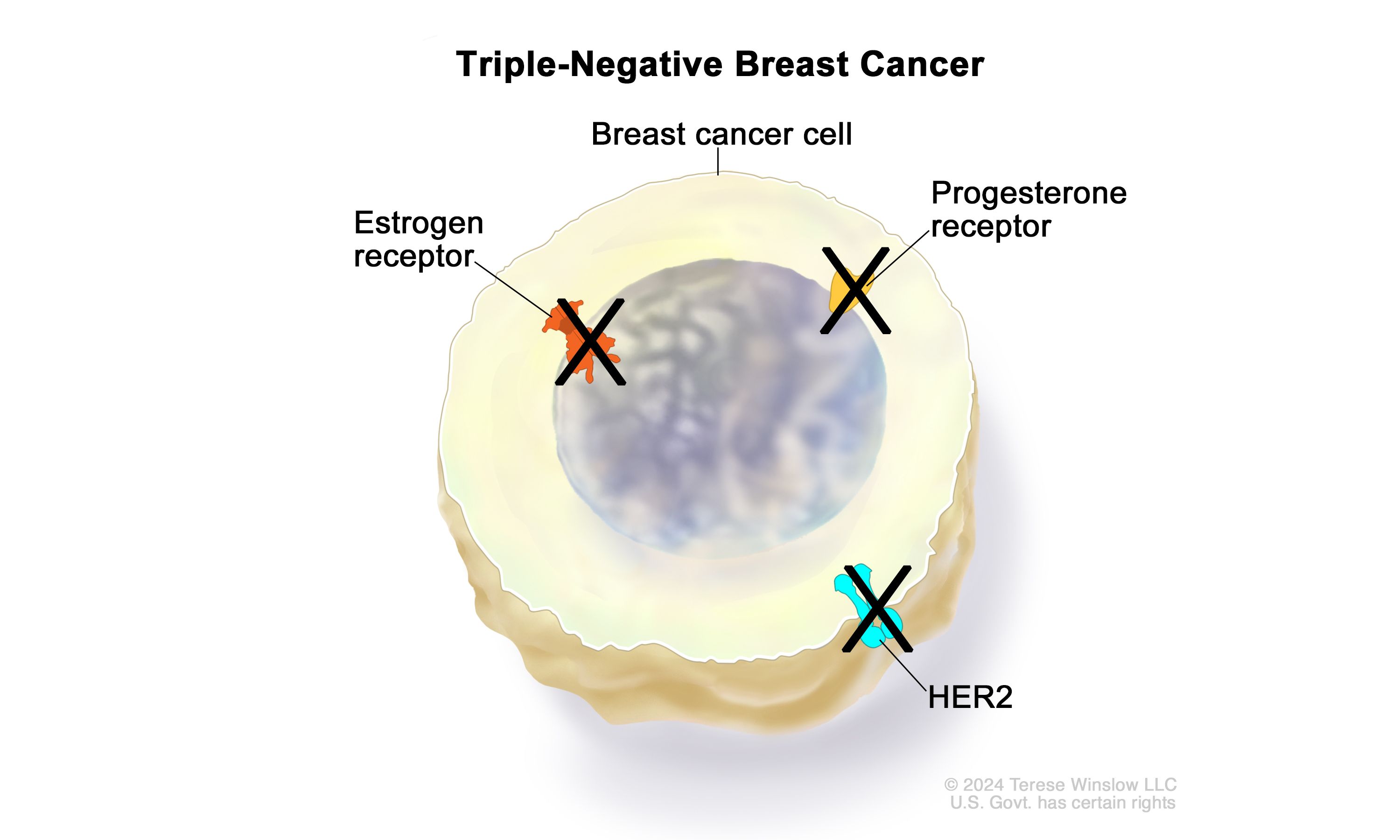 Triple Negative Breast Cancer