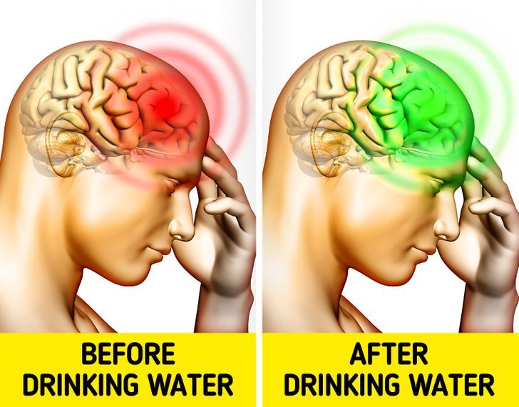 Can You Get Headaches from Drinking Too Much Water