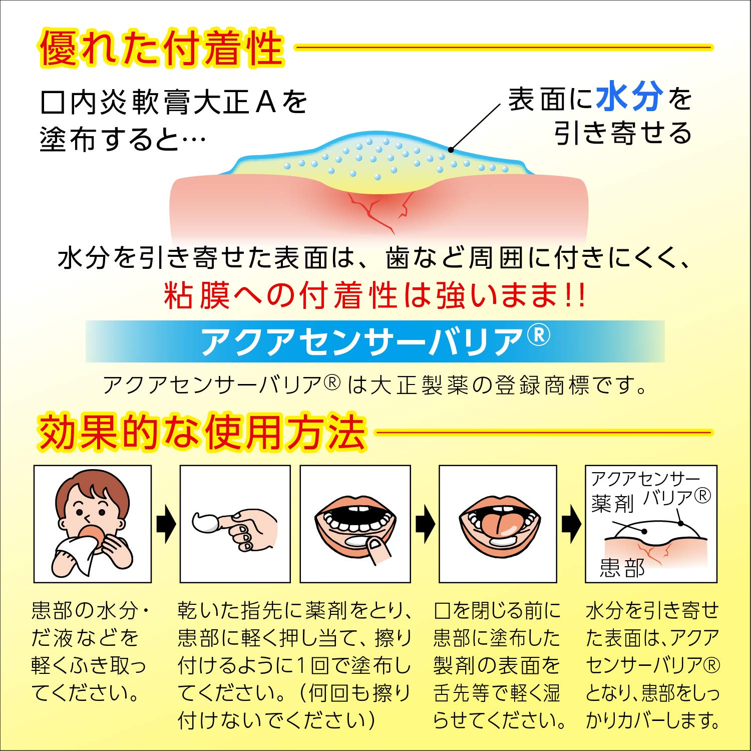 口内炎の治し方裏ワザ検証！一晩で激痛を抑える医学的処置とNg習慣