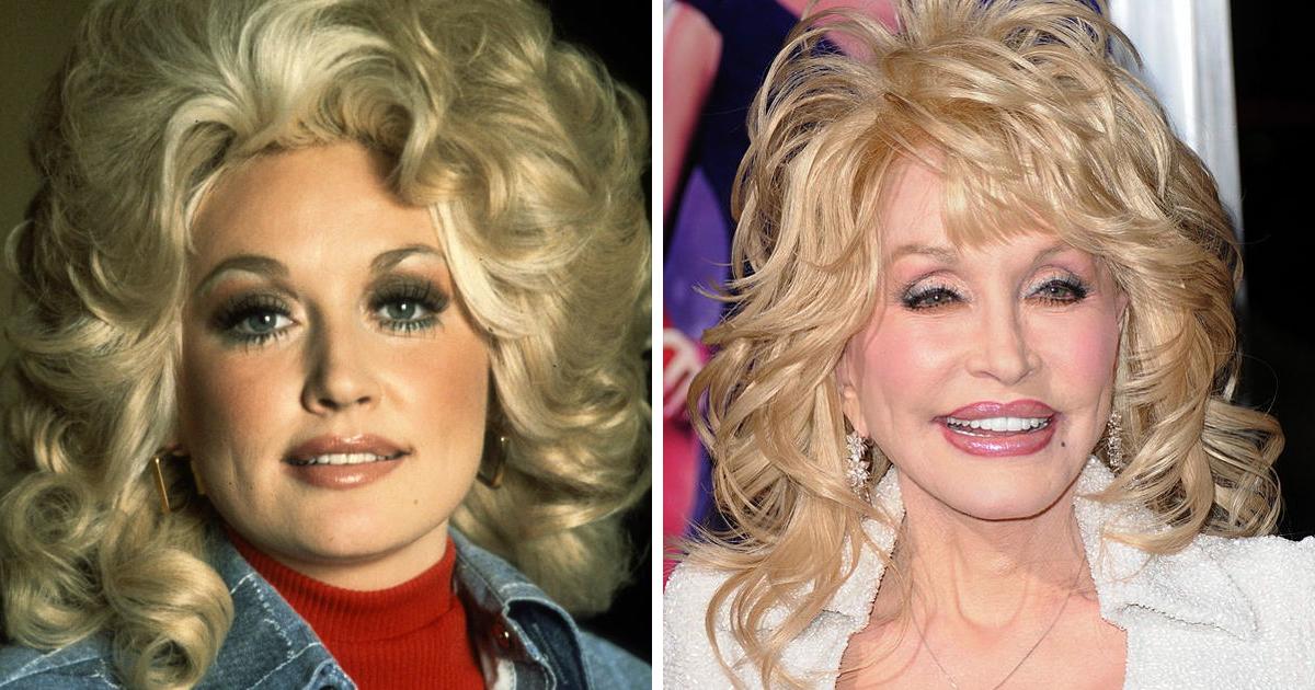 What Is Dolly Parton Age