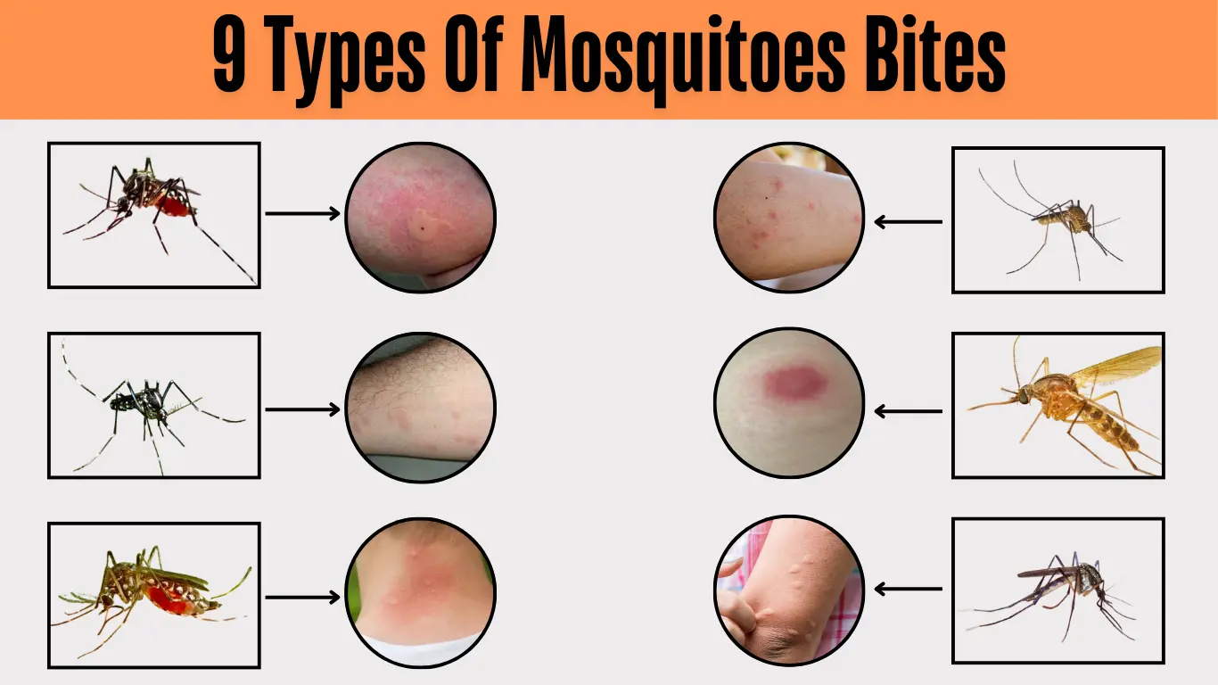 Are Mosquito Bites Dangerous in Uk