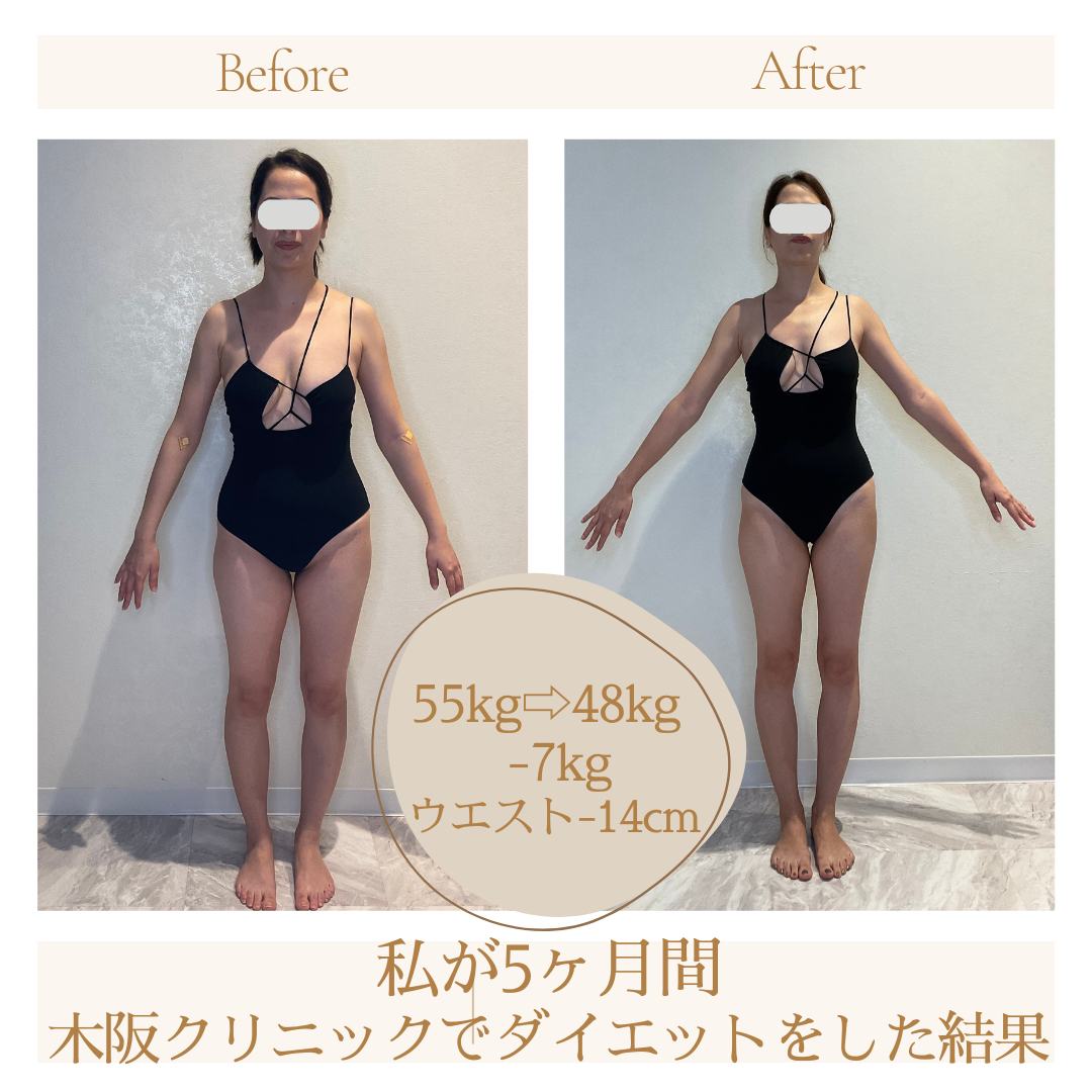 木坂クリニックの評判と待ち時間は？受診前の予約法や診療科目を徹底解説