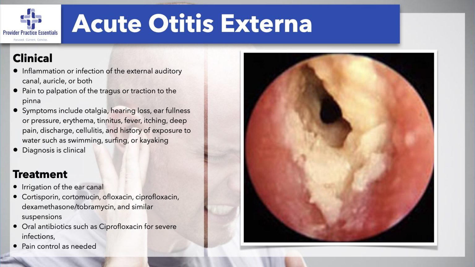 Signs of Otitis Externa