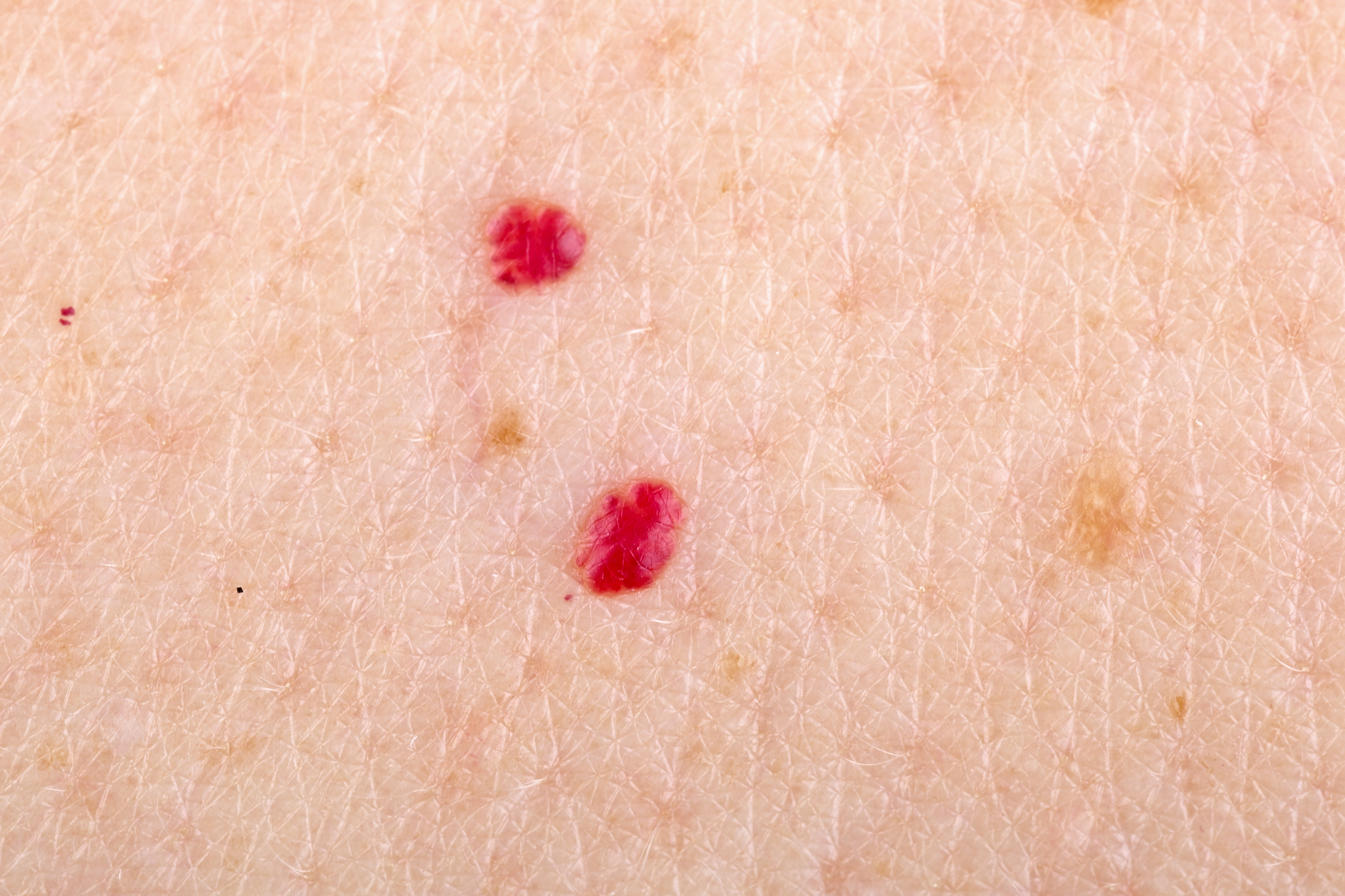Tiny Red Bumps Randomly on Skin