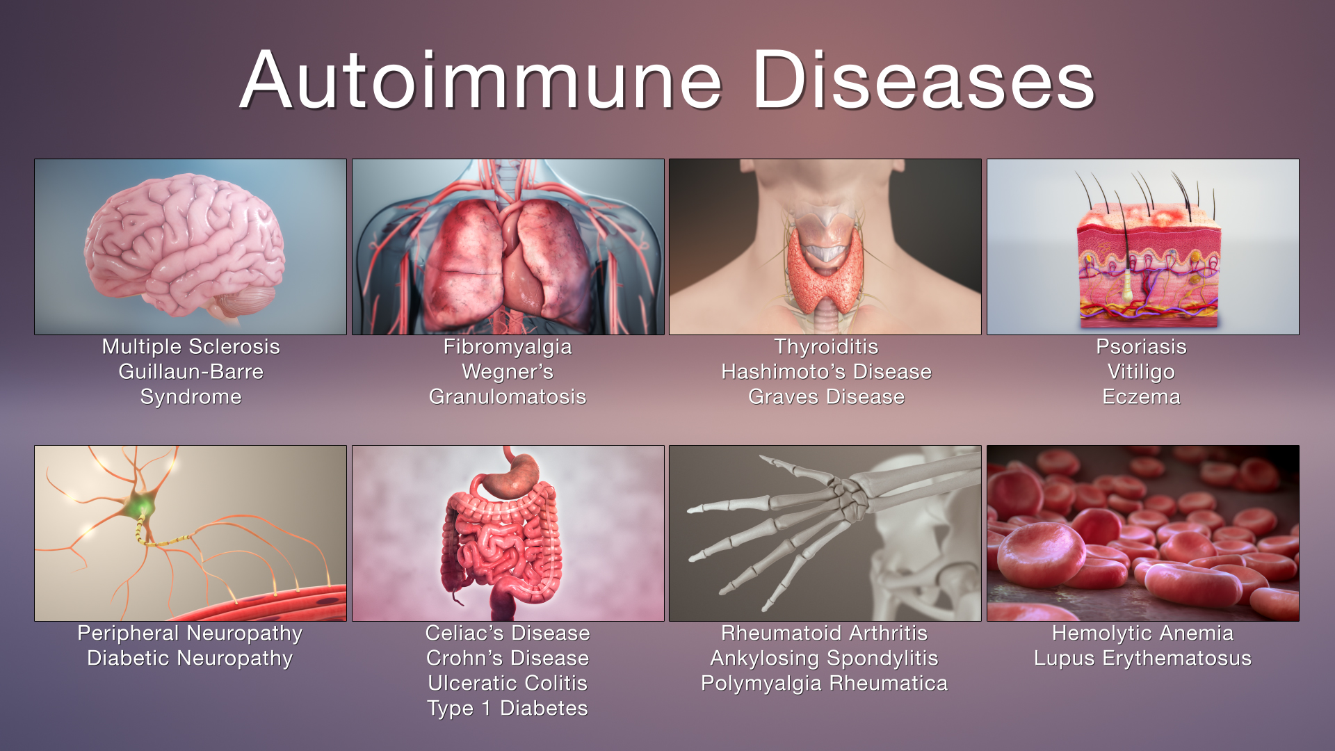 Why Do Autoimmune Diseases Happen