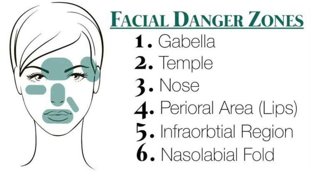 Danger Zones Where Not to Inject Botox Forehead