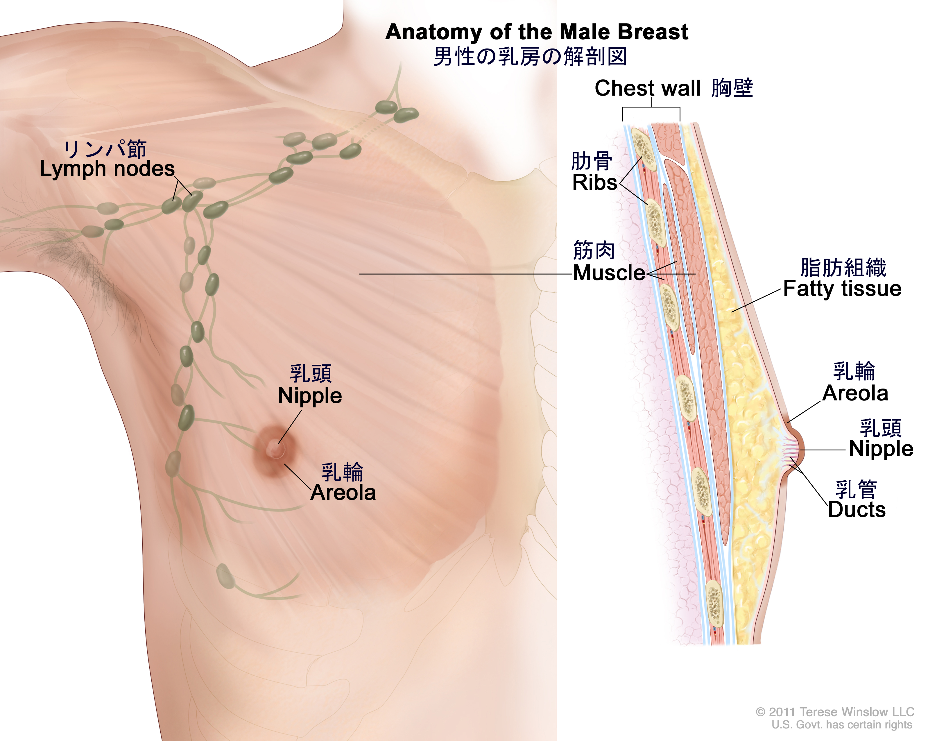 男の胸のしこりと痛みの正体とは？乳がんや女性化乳房の見分け方と受診科