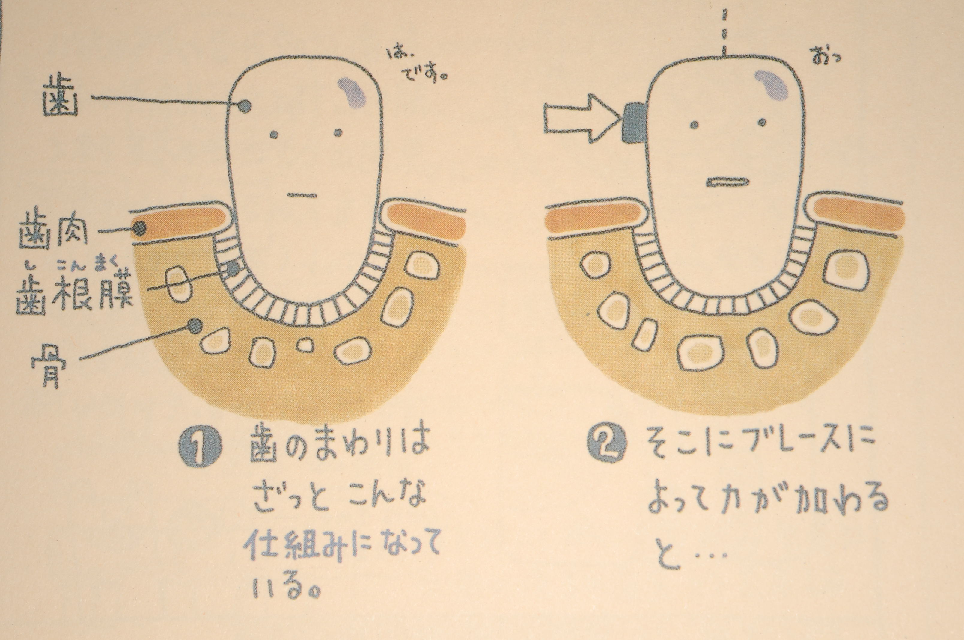 歯の矯正の激痛は耐えられない？痛みのピーク時期と後悔しない全知識