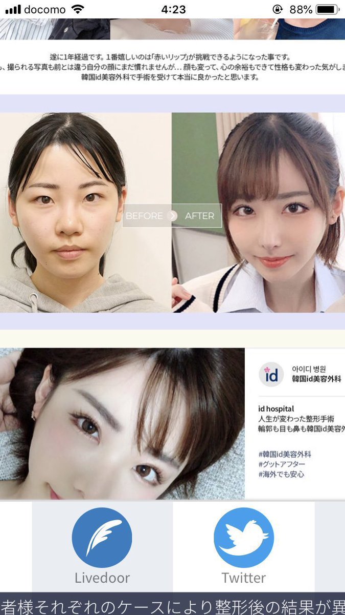 深田えいみの整形総額と施術箇所は？昔の写真と現在の変化を徹底検証