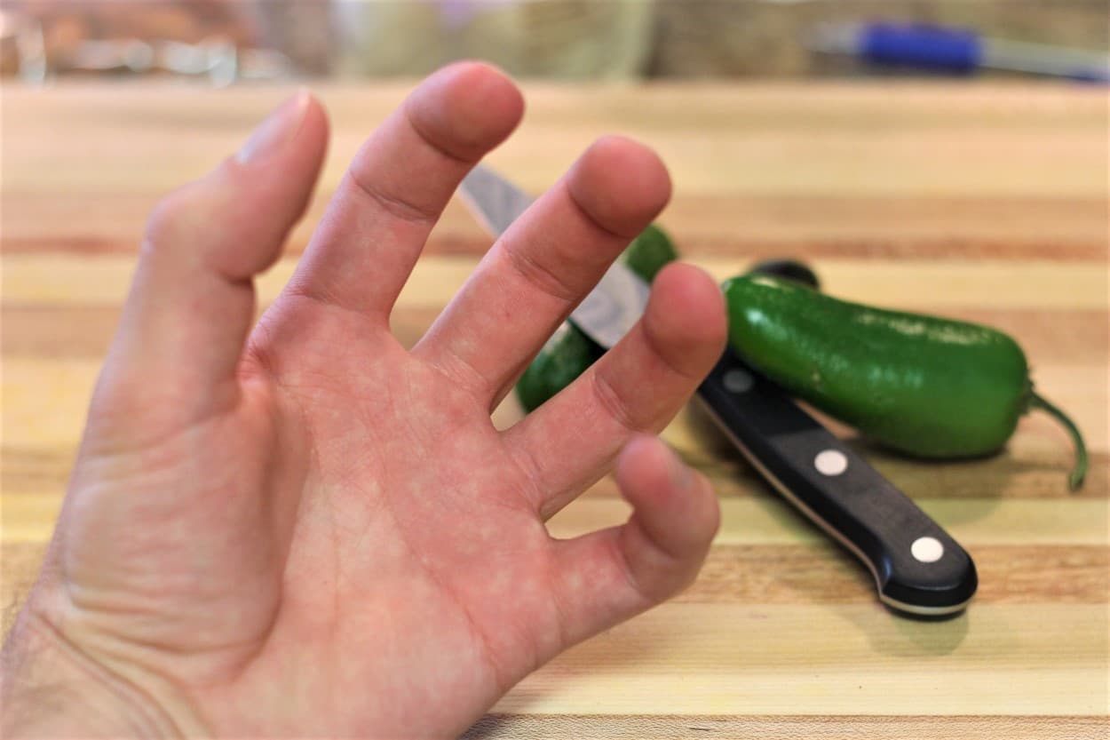 Can a Jalapeno Burn Your Skin