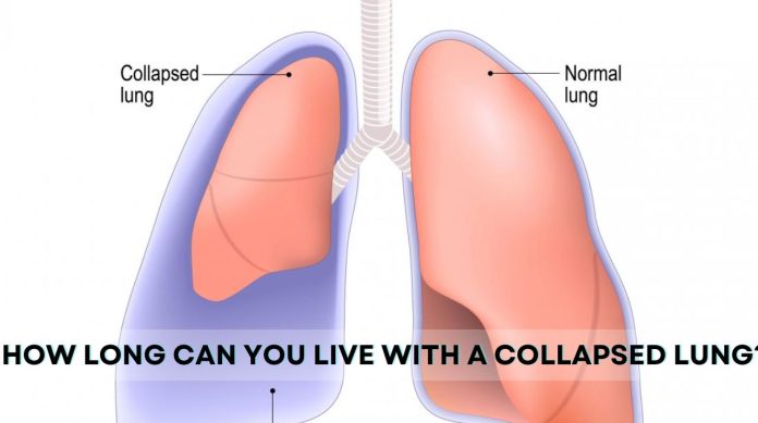 How Long Can You Survive with a Collapsed Lung