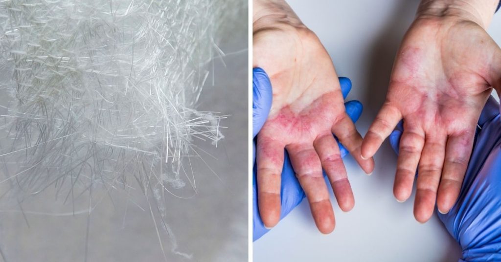 How to Get Rid of Itchy Fiberglass