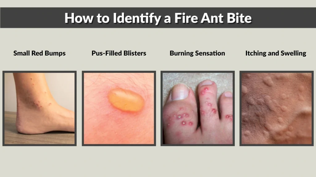 What Does a Ant Bite Look Like