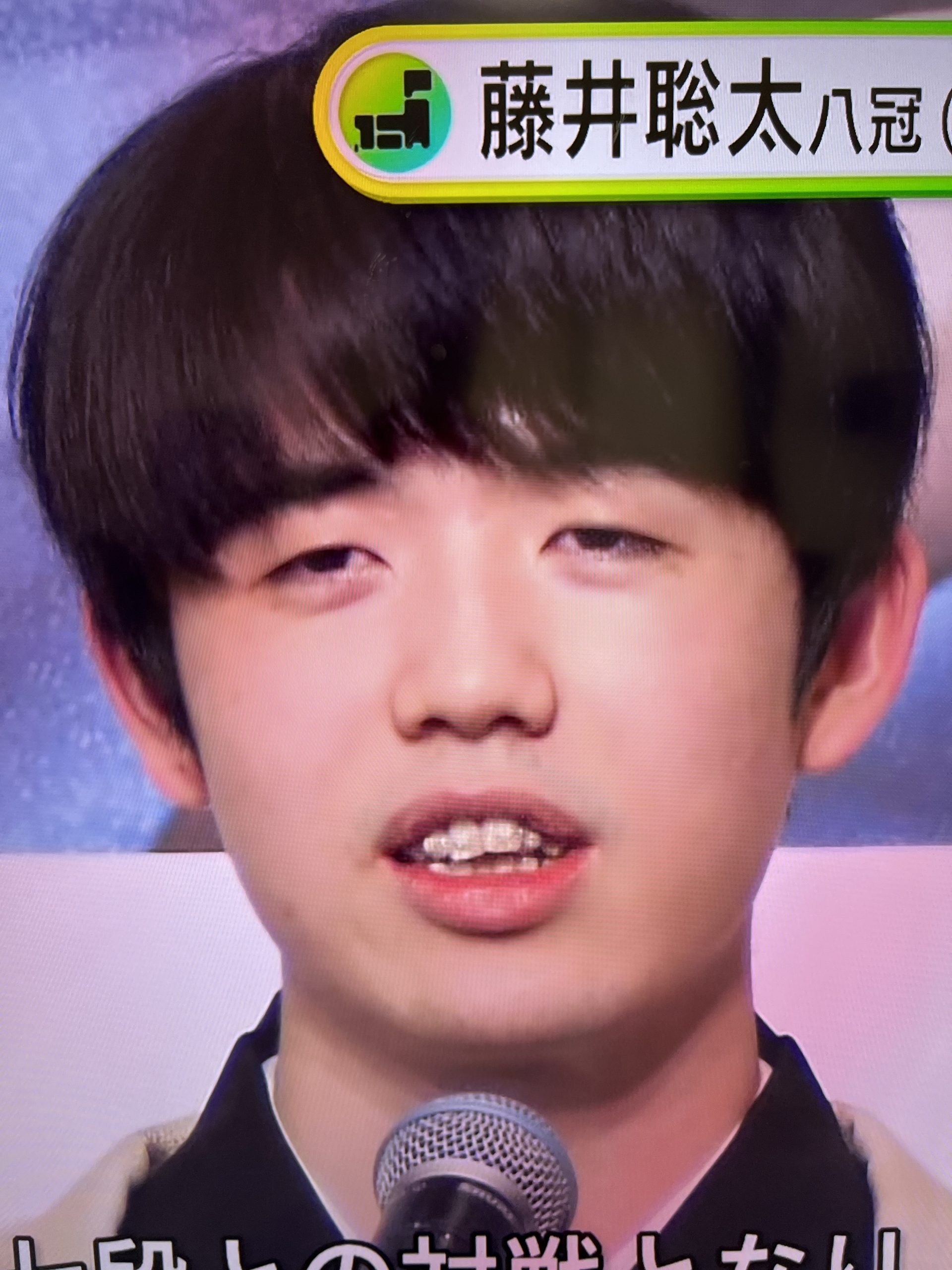 藤井聡太の歯科矯正ビフォーアフター！歯並び変化と勝負強さの真相