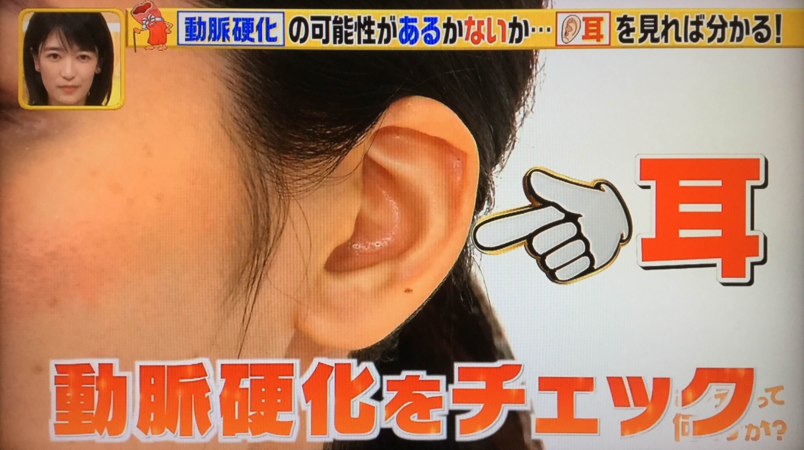 耳たぶの斜めのしわは動脈硬化の兆候？簡単セルフチェックと真相